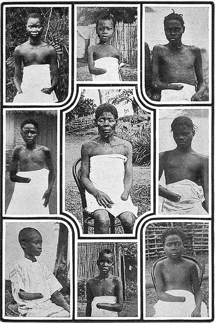 Historical photographs of Congolese people showing mutilations